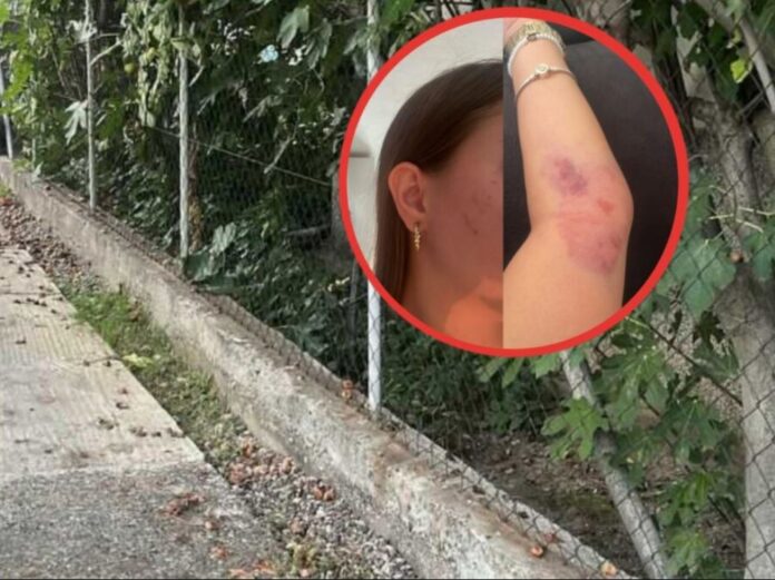 Porodica ogorčena nakon napada na djevojku u Modriči: “Osumnjičeni pušten da se brani sa slobode”